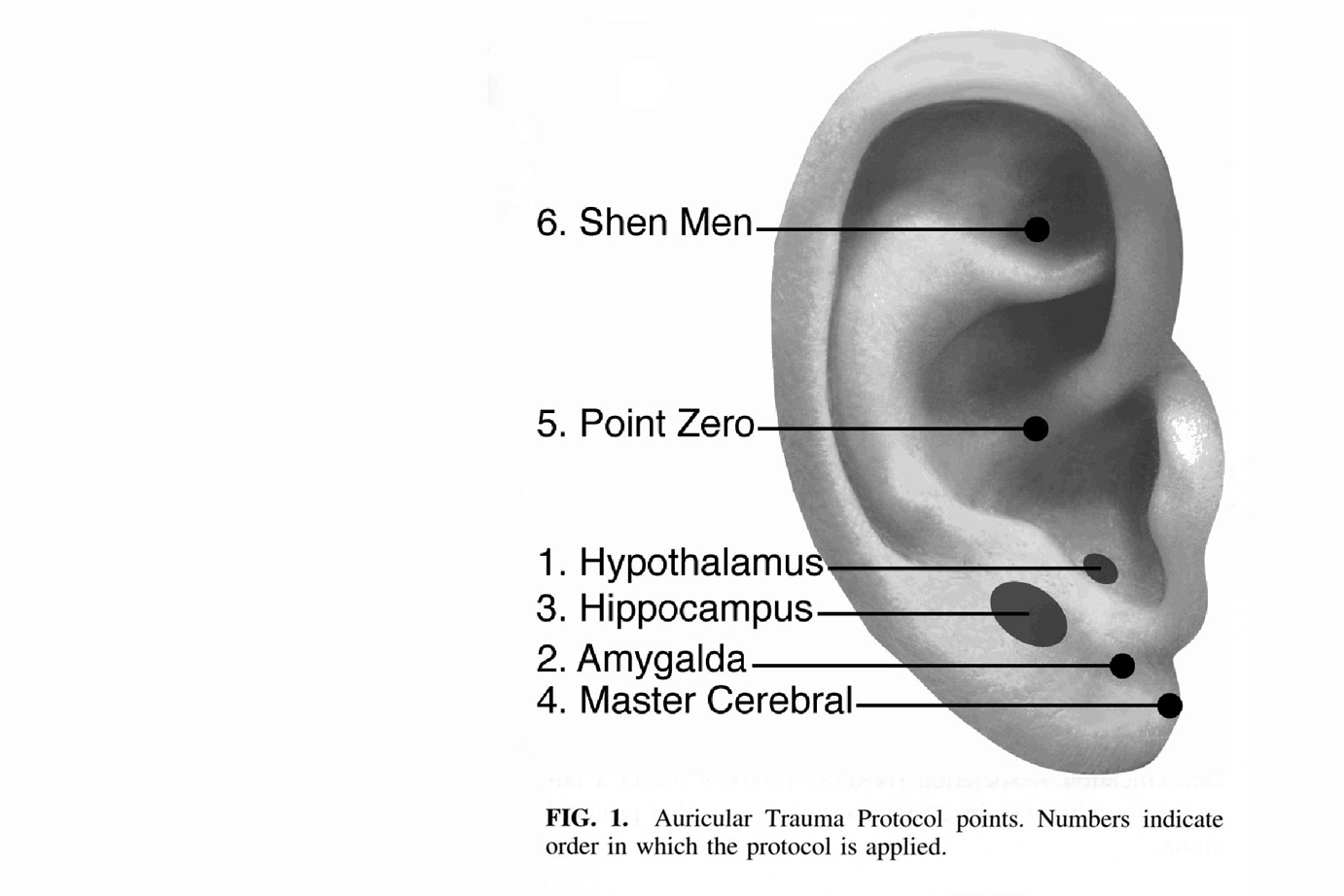 Joe Helms - Auricular Trauma Protocol / Pan Pacific Acupuncture ...